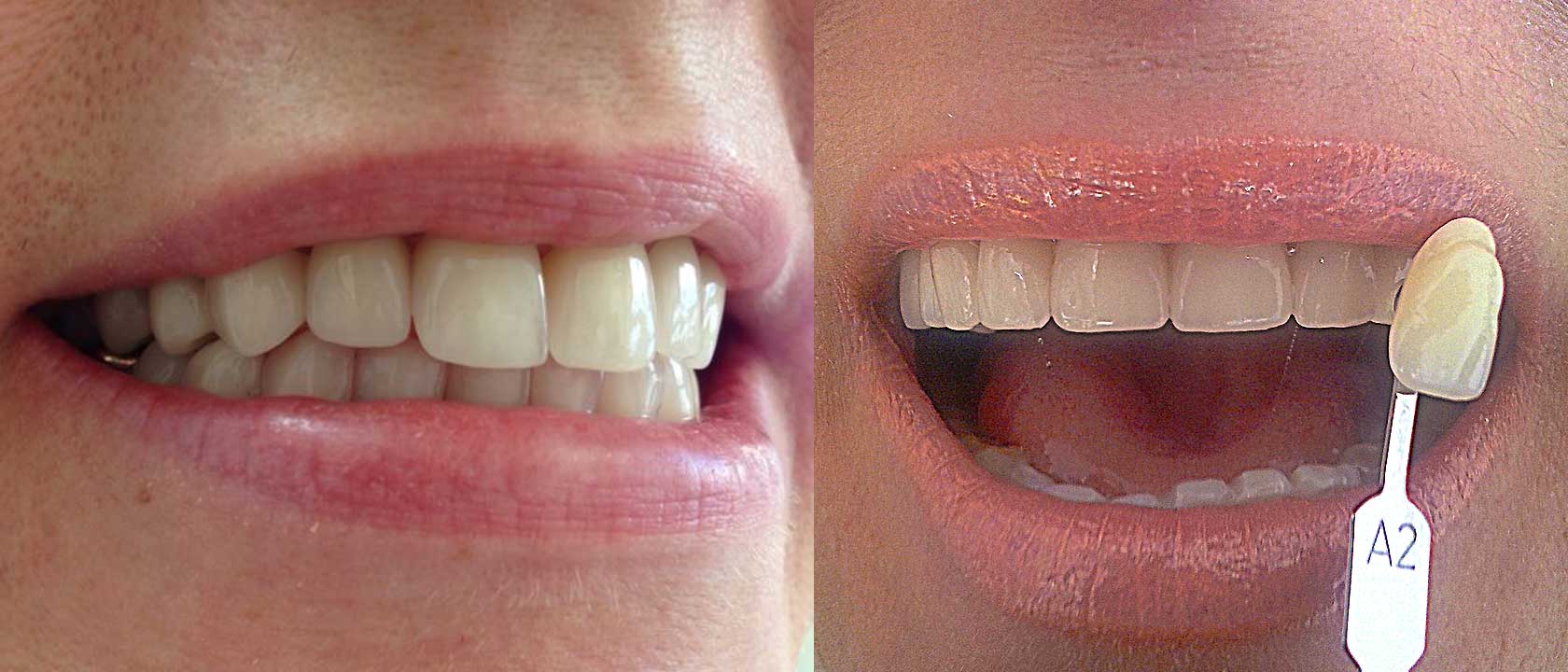 SMTL AUGSBURG DENTAL Ltd.